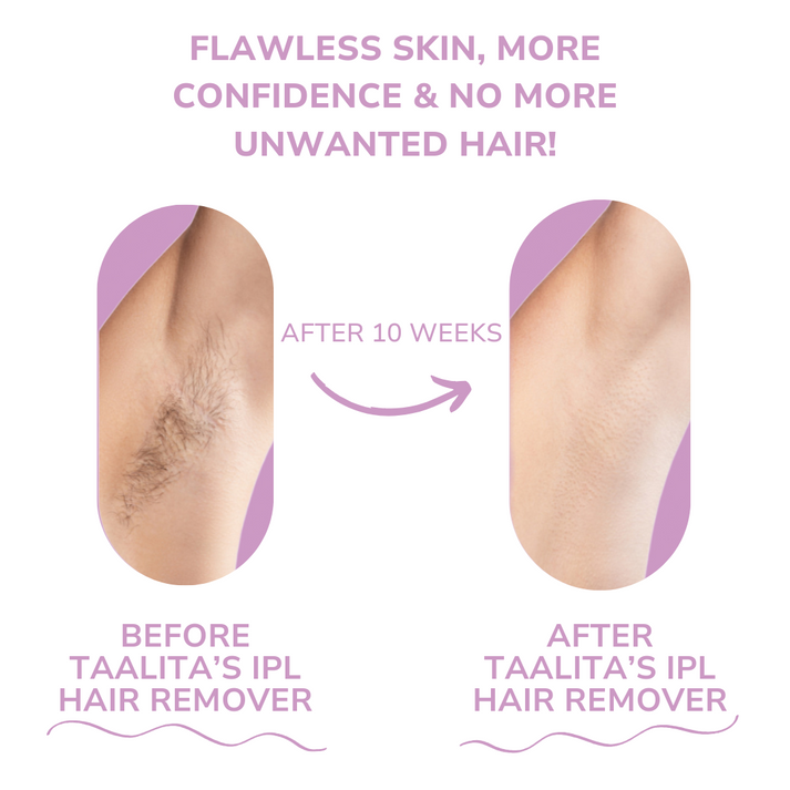 Skin™ IPL Hair Removal | The leading laser hair removal for your home